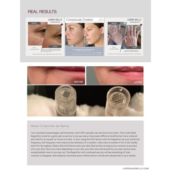 Lorde + Belle Viral RegenPen PEN ONLY Botox Alternative MSRP $299 No Cartridge - Picture 11 of 11